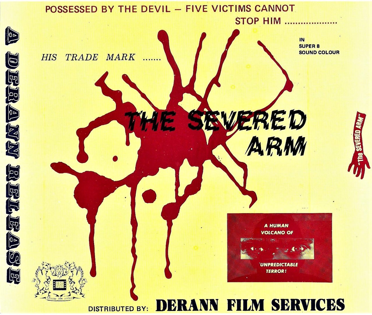 The Severed Arm